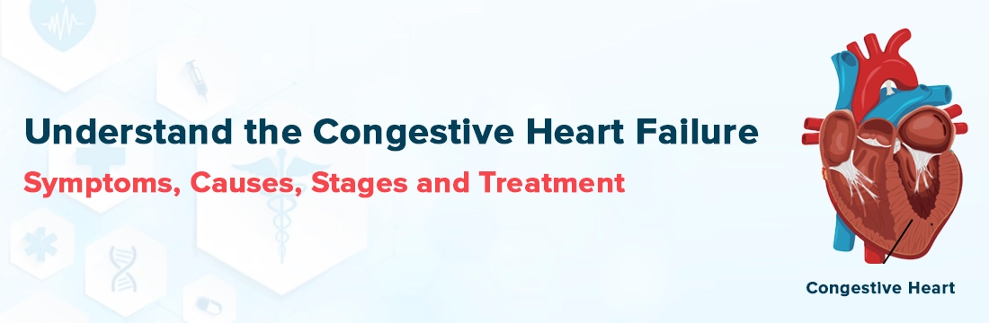 Understand The Congestive Heart Failure Symptoms, Causes, Stages and Treatment